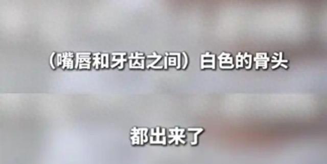 医生举报3岁男童疑遭生父虐待？警方最新回应来了