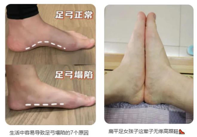 年轻人捧红日本“足力健”，王铁梅也在穿