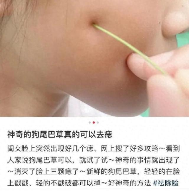 用狗尾巴草点痣？有癌变风险！