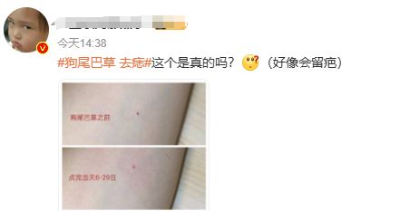 用狗尾巴草点痣？有癌变风险！