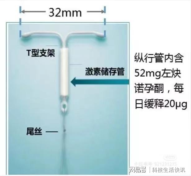 曼月乐缝合医院也没稳住？换这家不缝合医院一次成功