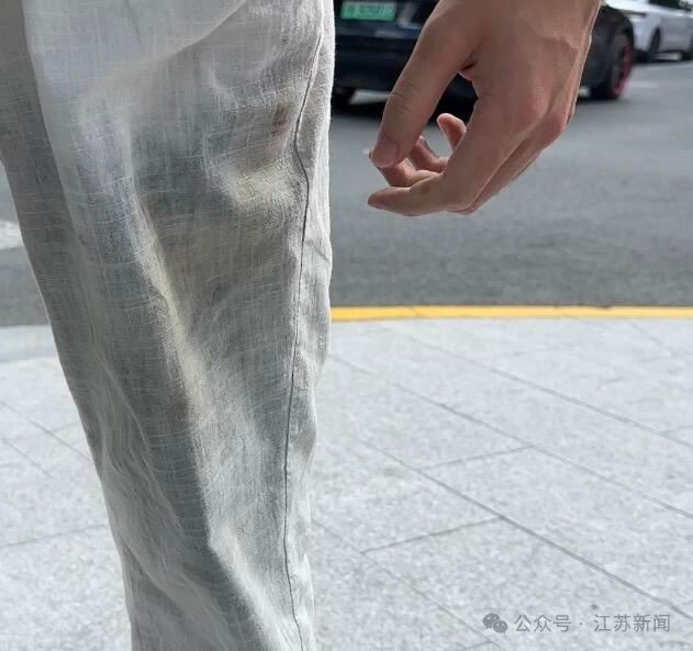大腿三度烧伤！随身携带的充电宝突然自燃，网友称非召回批次