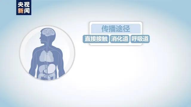 4岁娃腿疼发烧一整年，元凶竟是一杯奶！