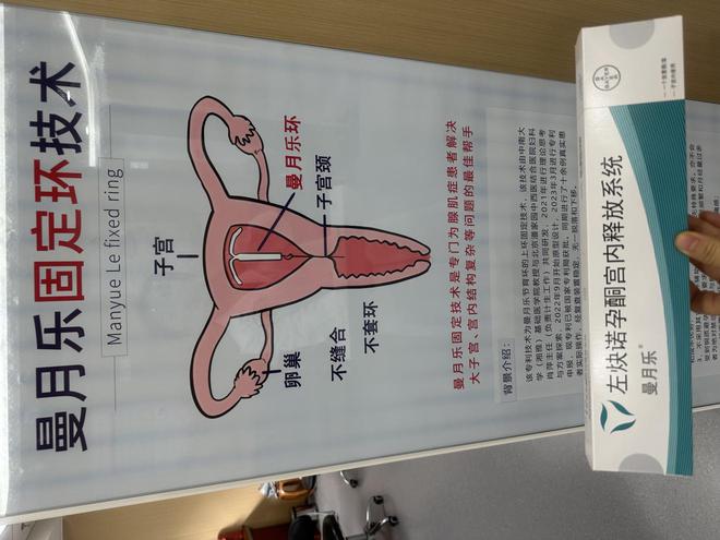 曼月乐下移，曼月乐+吉尼固定与非缝合固定术区别在哪？