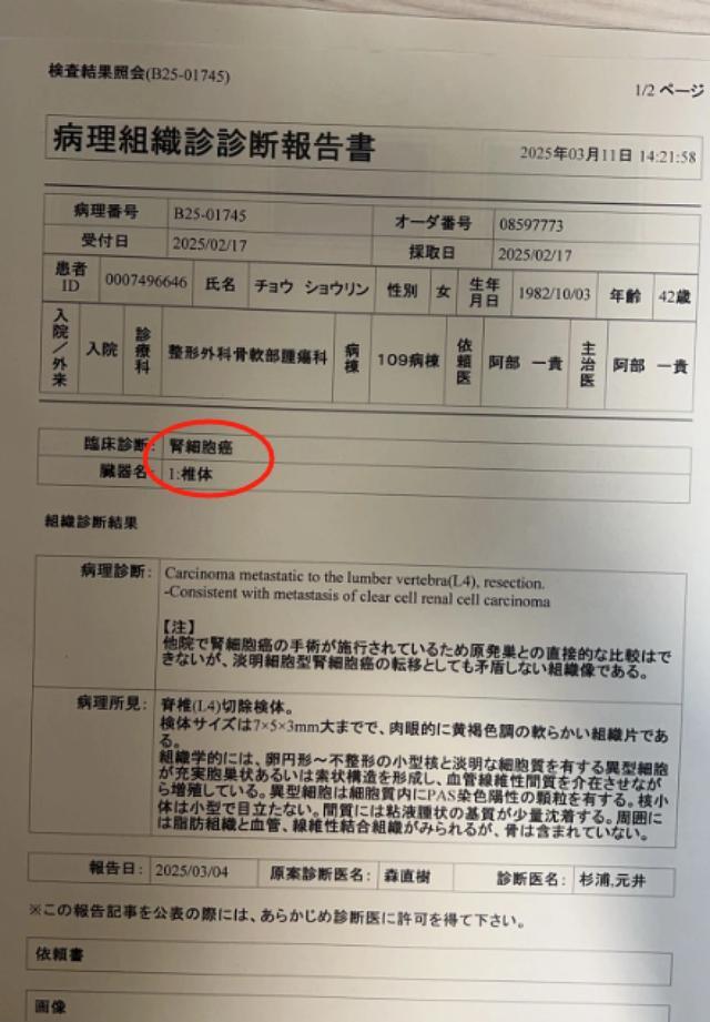 体检10年未提示风险却查出癌症晚期 女律师质疑“假体检”